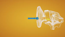 Load and play video in Gallery viewer, LugGuards Deluxe Ear Wax Removal Kit
